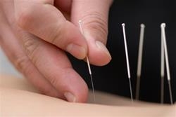 Photo from goacupuncture.com.