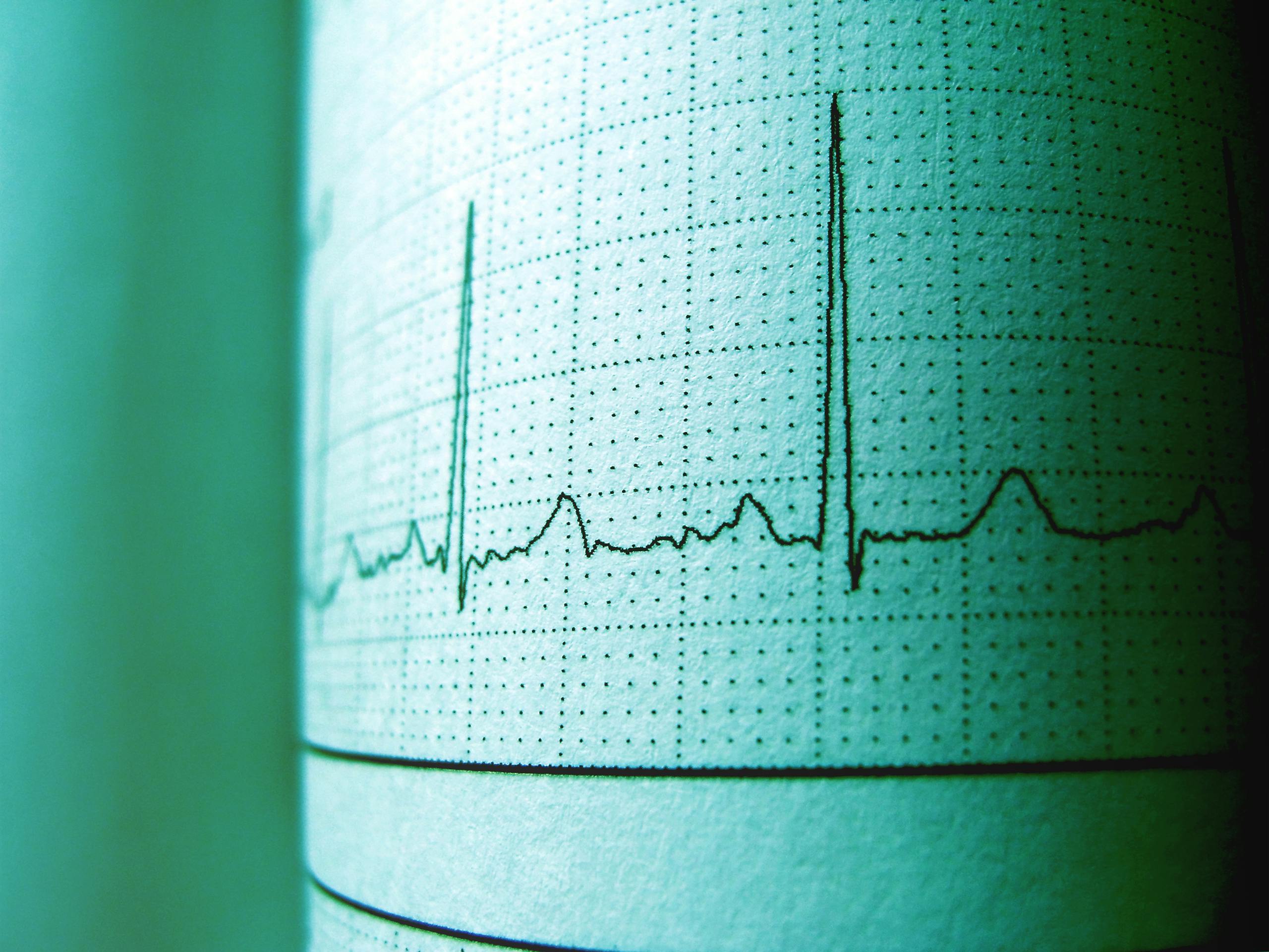Tricuspid Brinkmanship: Are We Overhyping the Right-Sided Revolution?