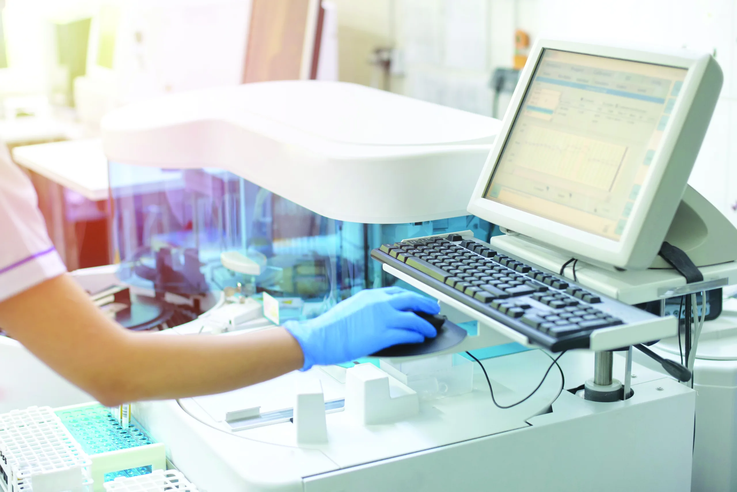 Lumo™: AI-Powered Response Factor Prediction for E&L